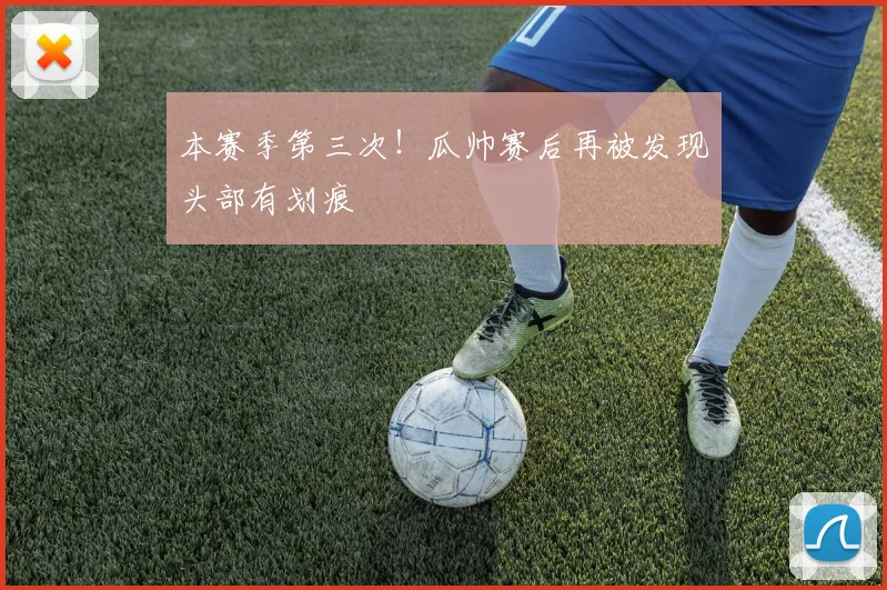 本赛季第三次！瓜帅赛后再被发现头部有划痕